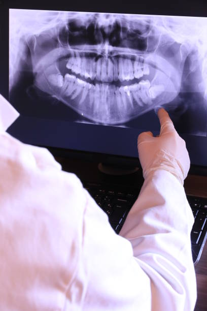 Best Emergency Treatment for Dental Infections or Abscesses in Hudson, OH